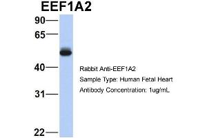 Host:  Rabbit  Target Name:  EEF1A2  Sample Type:  Human Fetal Heart  Antibody Dilution:  1. (EEF1A2 anticorps  (Middle Region))
