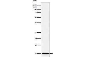 Western blot analysis of NDUFA1 expression in A673 cell lysate.
