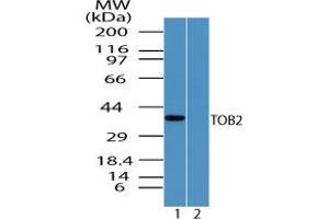 Image no. 1 for anti-Transducer of ERBB2, 2 (TOB2) (AA 50-100) antibody (ABIN960385) (TOB2 anticorps  (AA 50-100))