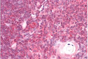 ABIN185580 (5µg/ml) staining of paraffin embedded Human Thymus. (DDX6 anticorps  (C-Term))