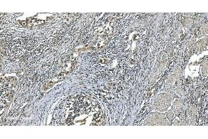 IHC analysis of LSM7 using anti-LSM7 antibody (ABIN7598937). (LSM7 anticorps  (AA 1-103))