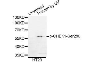 Western blot analysis of extracts of HT-29 cells, using Phospho-CHEK1-Ser280 antibody (ABIN5969878). (CHEK1 anticorps  (pSer280))