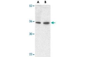 Western blot analysis of TRIM5 gamma expression in human bladder (A) and colon (B) tissue lysate with TRIM5 gamma polyclonal antibody  at 2 ug /mL . (TRIM5 anticorps  (C-Term))