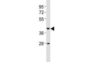 Western blot testing of CB2 antibody at 1:2000 dilution + human brain lysate.