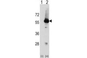 Western Blotting (WB) image for anti-serine/threonine Kinase 3 (STK3) antibody (ABIN2998524)