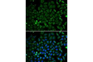 Immunofluorescence analysis of A549 cells using PARK2 antibody (ABIN5998454). (Parkin anticorps)