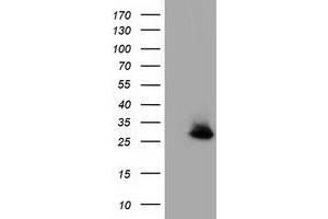 Western Blotting (WB) image for anti-Glutathione S-Transferase theta 2 (GSTT2) antibody (ABIN1498558) (GSTT2 anticorps)