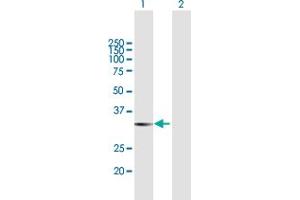 Western Blot analysis of LGALS8 expression in transfected 293T cell line by LGALS8 MaxPab polyclonal antibody. (LGALS8 anticorps  (AA 1-317))