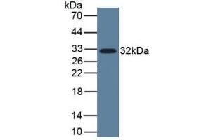 Detection of IL33 in Human Lung Tissue using Monoclonal Antibody to Interleukin 33 (IL33) (IL-33 anticorps  (AA 112-270))