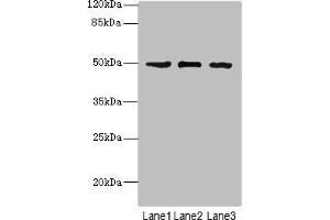 Western blot All lanes: CSNK1G1 antibody at 1. (CSNK1G1 anticorps  (Isoform gamma 1))