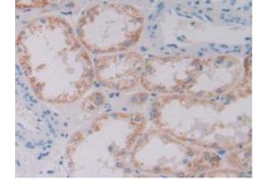 IHC-P analysis of Human Kidney Tissue, with DAB staining. (GDF6 anticorps  (AA 336-455))