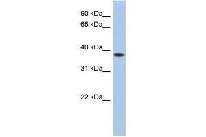 WB Suggested Anti-ZFP36 Antibody Titration:  0. (ZFP36 anticorps  (N-Term))