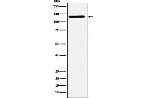 Western blot analysis of SF3B3 expression in HeLa cell lysate.