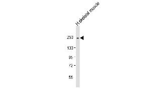 Anti-MYH2 Antibody (N-Term) at 1:2000 dilution + human skeletal muscle lysate Lysates/proteins at 20 μg per lane.