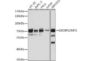 Western blot analysis of extracts of various cell lines, using IGF2BP2/IMP2 antibody (ABIN6131799, ABIN6142242, ABIN6142244 and ABIN6218878) at 1:1000 dilution.