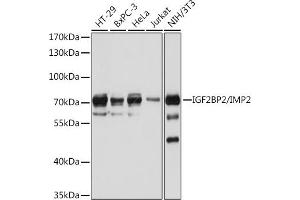 Western blot analysis of extracts of various cell lines, using IGF2BP2/IMP2 antibody (ABIN6131799, ABIN6142242, ABIN6142244 and ABIN6218878) at 1:1000 dilution. (IGF2BP2 anticorps  (AA 330-599))