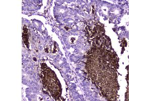 IHC analysis of Lactoferrin using anti-Lactoferrin antibody .