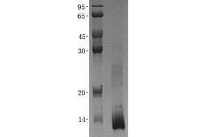 Validation with Western Blot