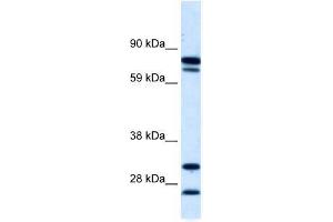 ZNF606 antibody used at 5 ug/ml to detect target protein. (ZNF606 anticorps  (N-Term))