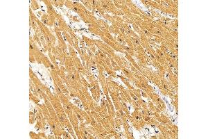 IHC analysis of RYR2 using anti-RYR2 antibody (ABIN7599921).