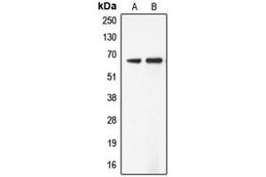 Western blot analysis of ADCK5 expression in Jurkat (A), SW13 (B) whole cell lysates. (ADCK5 anticorps  (Center))