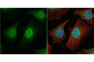 ICC/IF Image Survivin antibody detects Survivin protein at nucleus by immunofluorescent analysis.