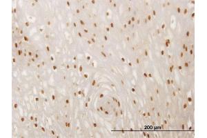 Immunoperoxidase of monoclonal antibody to SMAD6 on formalin-fixed paraffin-embedded human esophagus. (SMAD6 anticorps  (AA 285-384))