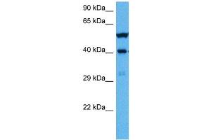 Host:  Mouse  Target Name:  WT1  Sample Tissue:  Mouse Brain  Antibody Dilution:  1ug/ml