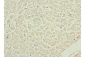 Immunohistochemistry of paraffin-embedded human heart tissue using ABIN7150145 at dilution of 1:100