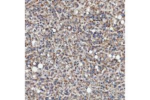 IHC analysis of SFXN3 using anti-SFXN3 antibody (ABIN7601302). (SFXN3 anticorps  (AA 32-321))