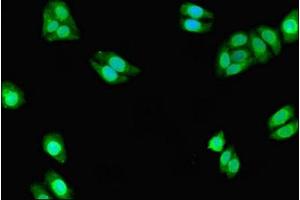 Immunofluorescent analysis of HepG2 cells using ABIN7149266 at dilution of 1:100 and Alexa Fluor 488-congugated AffiniPure Goat Anti-Rabbit IgG(H+L)