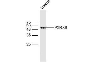 Mouse uterus lysates probed with P2RX6 Polyclonal Antibody, unconjugated  at 1:300 overnight at 4°C followed by a conjugated secondary antibody at 1:10000 for 60 minutes at 37°C. (P2RX6 anticorps  (AA 55-160))