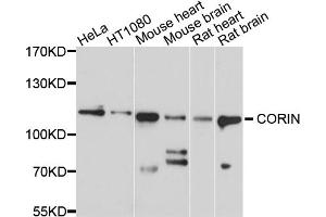 Western blot analysis of extracts of various cell lines, using CORIN antibody. (Corin anticorps)