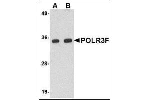 Western blot analysis of POLR3F in human brain tissue lysate with this product at (A) 0. (POLR3F anticorps  (N-Term))