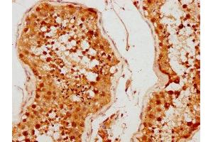 IHC image of ABIN7159140 diluted at 1:500 and staining in paraffin-embedded human testis tissue performed on a Leica BondTM system. (MED26 anticorps  (AA 372-523))