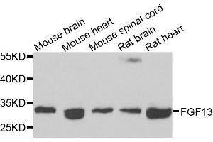 Western blot analysis of extracts of various cells, using FGF13 antibody. (FGF13 anticorps)