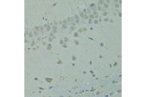 Immunohistochemistry of paraffin-embedded rat brain using IVNS1ABP antibody (ABIN1873334) at dilution of 1:100 (40x lens). (IVNS1ABP anticorps)