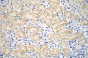 anti-Huntingtin (HTT) antibody