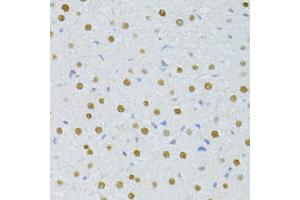 Immunohistochemistry of paraffin-embedded rat liver using SNRNP70 antibody (ABIN1877092) at dilution of 1:100 (40x lens). (SNRNP70 anticorps)