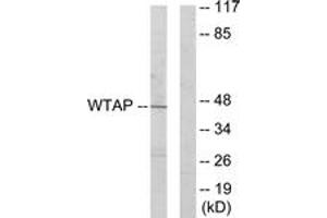 Western blot analysis of extracts from HuvEc cells, using WTAP Antibody. (WTAP anticorps  (AA 321-370))
