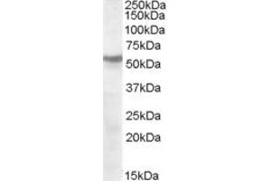 ABIN263185 (1µg/ml) staining of human cerebellum lysate (35µg protein in RIPA buffer). (CHRNB1 anticorps  (Internal Region))