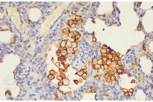 Immunohistochemistry of paraffin-embedded Rat lung using ANXA5 Ployclonal Antibody at dilution of 1:100. (Annexin V anticorps)
