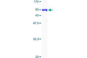 Image no. 2 for Calcium/calmodulin-Dependent Protein Kinase IG (CAMK1G) (AA 1-476) protein (GST tag) (ABIN1347921)