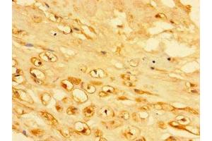 Immunohistochemistry of paraffin-embedded human placenta tissue using ABIN7157336 at dilution of 1:100 (KRTAP23-1 anticorps  (AA 1-65))
