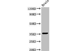 Western Blot Positive WB detected in: Mouse brain tissue All lanes: MNAT1 antibody at 3 μg/mL Secondary Goat polyclonal to rabbit IgG at 1/50000 dilution Predicted band size: 36, 32 kDa Observed band size: 36 kDa (MNAT1 anticorps  (AA 1-309))