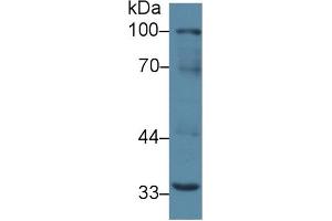 Detection of RANk in Mouse Liver lysate using Polyclonal Antibody to Receptor Activator Of Nuclear Factor Kappa B (RANk)