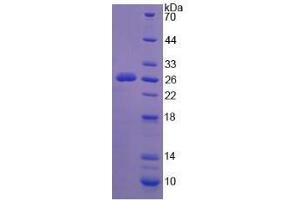 Image no. 1 for Sialidase 1 (Lysosomal Sialidase) (NEU1) (AA 141-286) (Active) protein (His tag) (ABIN5665883)