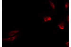 ABIN6274731 staining HeLa by IF/ICC. (MRPL15 anticorps  (Internal Region))