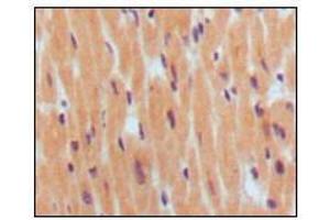 Immunohistochemical analysis of paraffin-embedded human normal myocardium, showing cytoplasmic localization using BNP1 mouse mAb with DAB staining. (BNP anticorps)