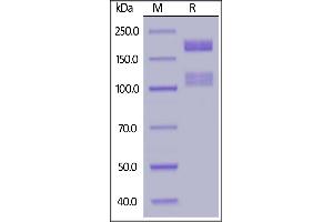 Human ITGA1&ITGB1 Heterodimer Protein, His Tag&Tag Free on  under reducing (R) condition.